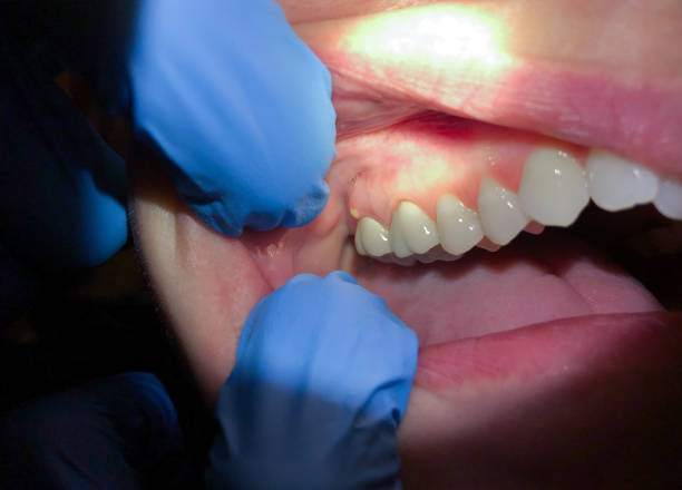 Best Cracked Tooth Emergency Dentist  in Rochester Hills, MI