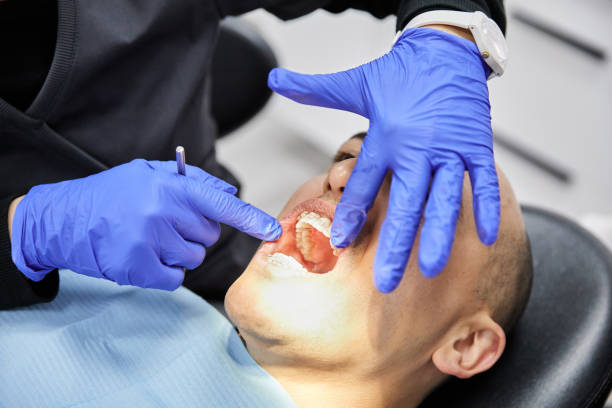 Best Chipped Tooth Repair Near Me  in Rochester Hills, MI